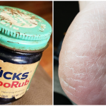 11 Ways To Use VapoRub That Aren't What It Was Made For