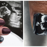 Pregnant Moms Now Using Their Sonograms For Nail Art